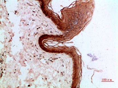 Cytokeratin 14/17 Polyclonal Antibody