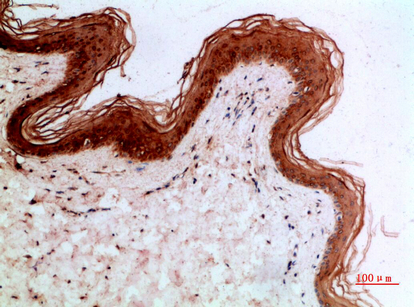 Cytokeratin 14/17 Polyclonal Antibody