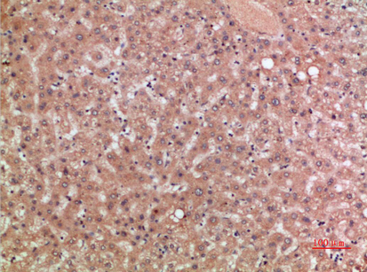 CKR-5 Polyclonal Antibody