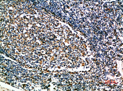 Cystatin A Polyclonal Antibody