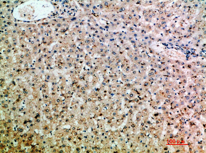 SOCS-2 Polyclonal Antibody