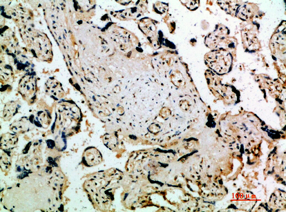 Flt-4 Polyclonal Antibody