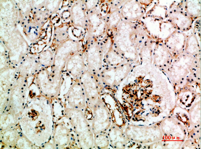 Endoglin Polyclonal Antibody