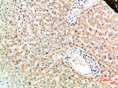 RANK Polyclonal Antibody