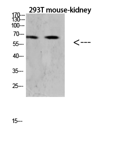 RANK Polyclonal Antibody