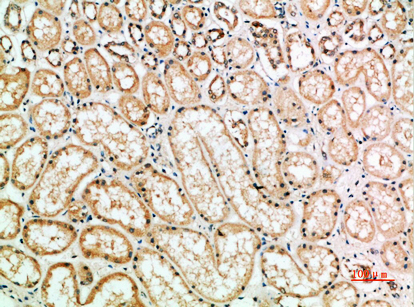 Galectin-1 Polyclonal Antibody