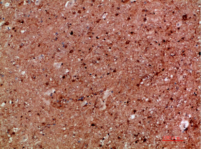 IKKγ Polyclonal Antibody