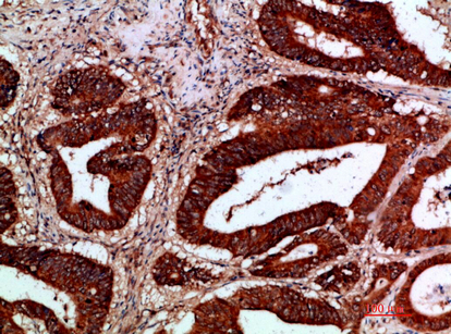 IKKγ Polyclonal Antibody