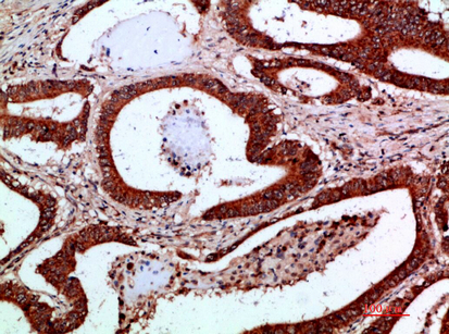 IKKγ Polyclonal Antibody