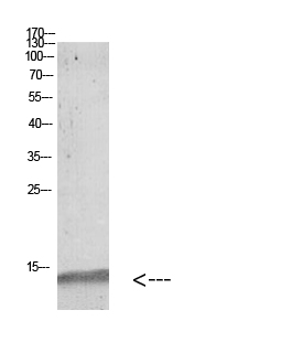 MAP LC3β Polyclonal Antibody