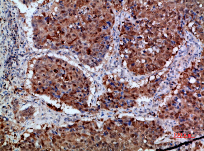 Integrin α1 Polyclonal Antibody