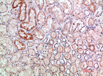 ANG I Polyclonal Antibody