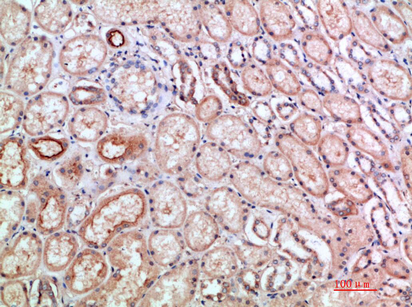 ANG I Polyclonal Antibody