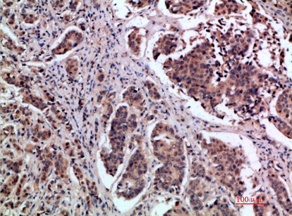 pS2 Polyclonal Antibody