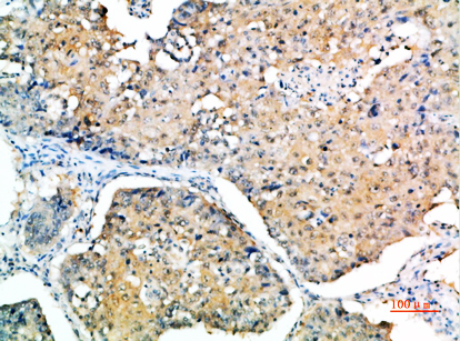 SOCS-3 Polyclonal Antibody