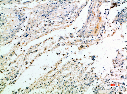 Versican Polyclonal Antibody