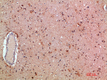 MLL Polyclonal Antibody