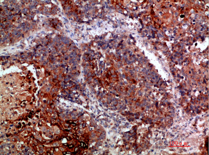 MLL Polyclonal Antibody