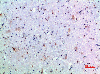 GH Polyclonal Antibody