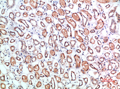 CD1B Polyclonal Antibody