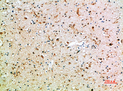 CD16 Polyclonal Antibody