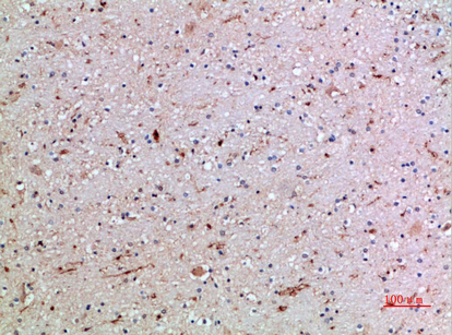 CD16 Polyclonal Antibody