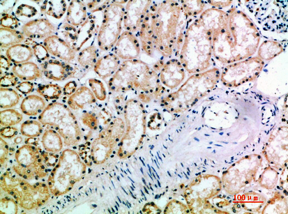 CD158k Polyclonal Antibody