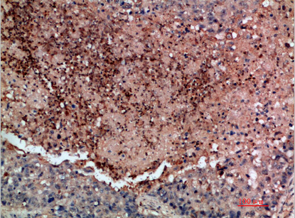 DDR2 Polyclonal Antibody