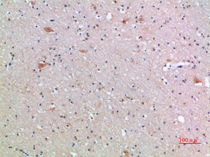 Frizzled-9 Polyclonal Antibody