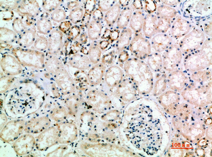 NCAM-L1 Polyclonal Antibody