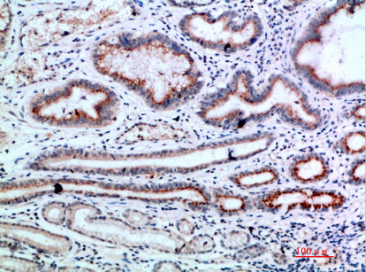 NCAM-L1 Polyclonal Antibody