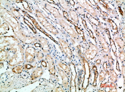 CD297 Polyclonal Antibody