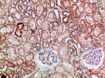 BTN3A1/2/3 Polyclonal Antibody