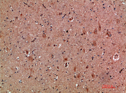 NNT-1 Polyclonal Antibody