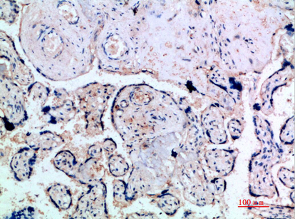 Inhibin α Polyclonal Antibody