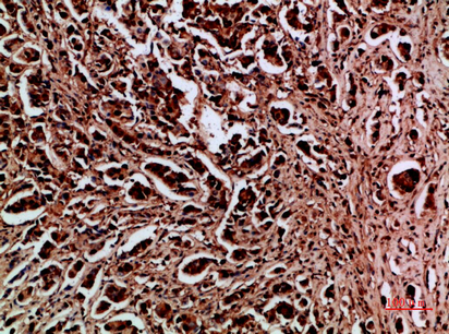 HDGF Polyclonal Antibody