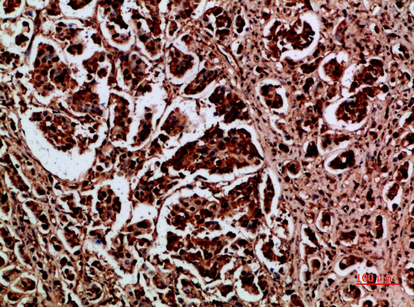 HDGF Polyclonal Antibody