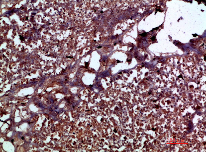 IL-17C Polyclonal Antibody