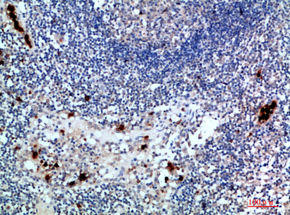 ZAP-70 Polyclonal Antibody