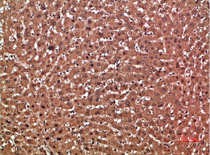 GSTA1 Polyclonal Antibody