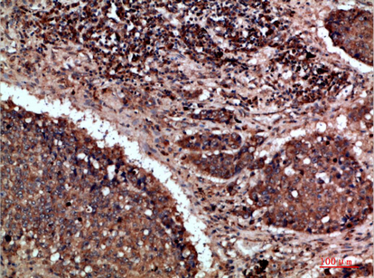 Napsin A Polyclonal Antibody