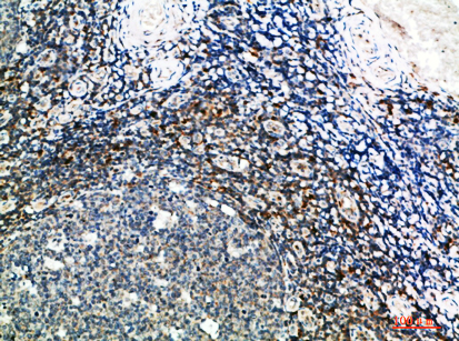 GSC Polyclonal Antibody