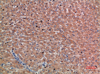 Chordin Polyclonal Antibody