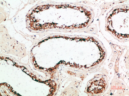 PACAP Polyclonal Antibody