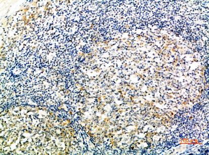 ATG10 Polyclonal Antibody