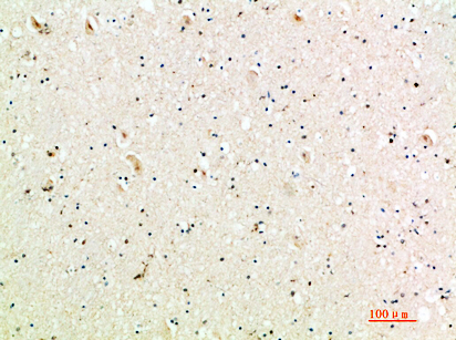 MIG Polyclonal Antibody