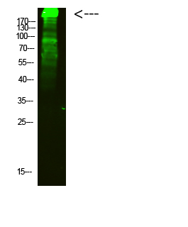 MYH6 Polyclonal Antibody