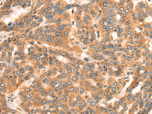 ADAP2 Antibody