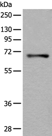 AK5 Antibody