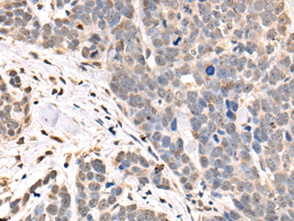 ASXL2 Antibody